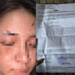 Setahun Mangkrak Laporan di Polsek Semampir, Pelapor Tagih Kejelasan